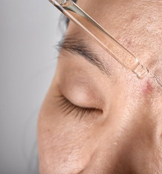66 Bekas Jerawat Susah Hilang Cek Serum Penghilang Bekas Jerawat Dari LOreal Paris